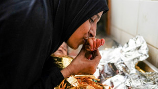 UN alarmed by Gaza war's toll on children, 'catastrophic' hunger