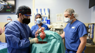 Des chirurgiens américains ont greffé avec succès le coeur d'un porc sur un humain
