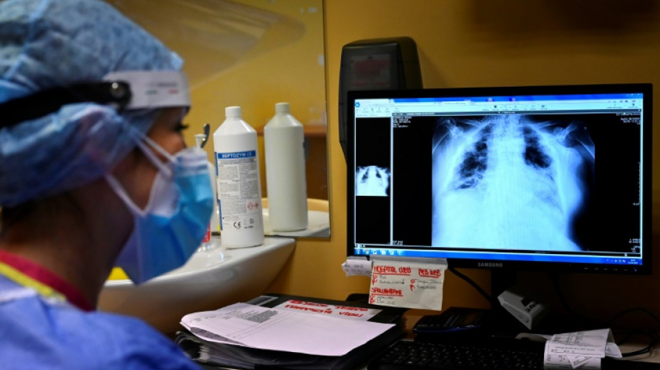 TB cases rise after years of decline: WHO