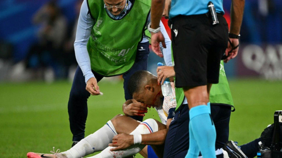 Mbappe breaks nose in France Euro 2024 win