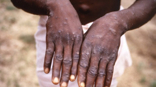 Monkeypox outbreak tops 1,000 cases, WHO warns of 'real' risk