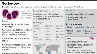 More than 200 cases of monkeypox worldwide: EU disease agency